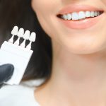 Dentist checking and selecting color of young woman's teeth.