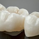 Metal free ceramic dental crowns. Imitation of a dental prosthesis of a dental bridge for three teeth on a grey background. Close-up
